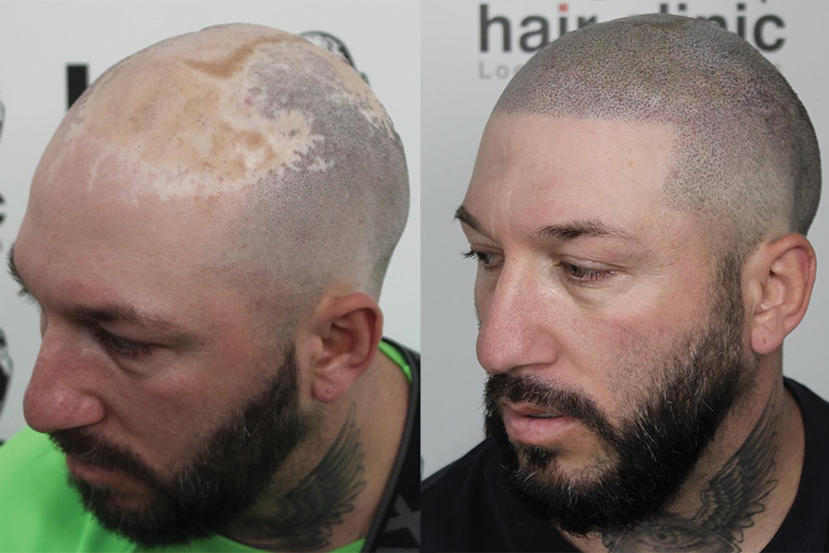 tatuaje de pelo