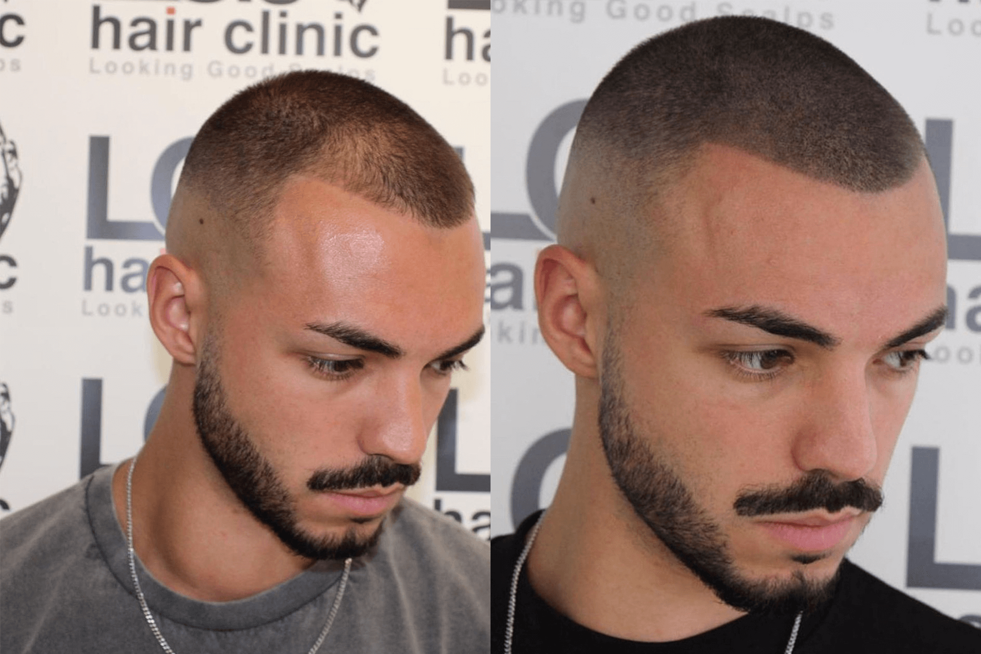 tatuaje de pelo