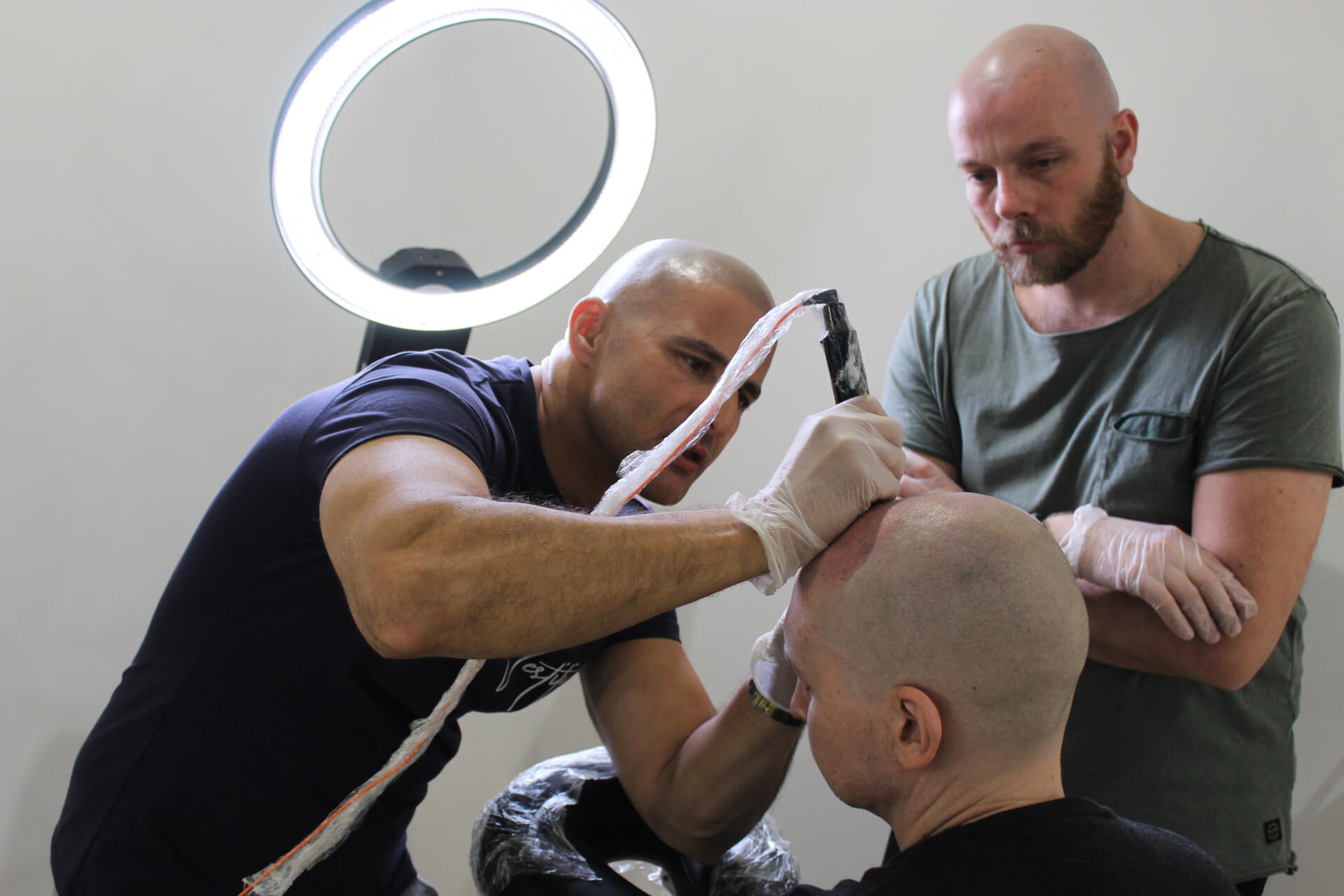scalp micropigmentation